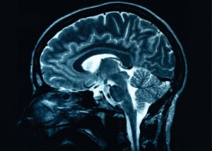 This is a magnetic resonance image slice of the human brain,   eventually this imaging tool will have molecular resolution.